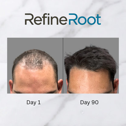 RefineRoot™ Scalp Renewal Kit